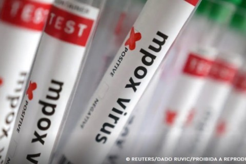Sobe para 140 número de casos confirmados de Mpox no país, em 2026